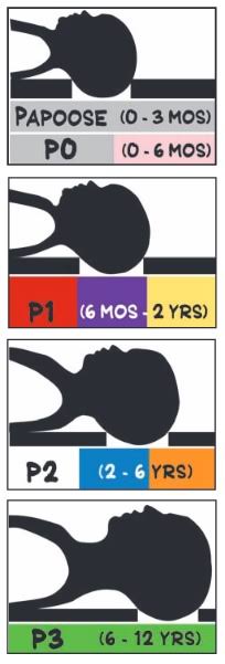 Thoracic Extension Only Adult P7352